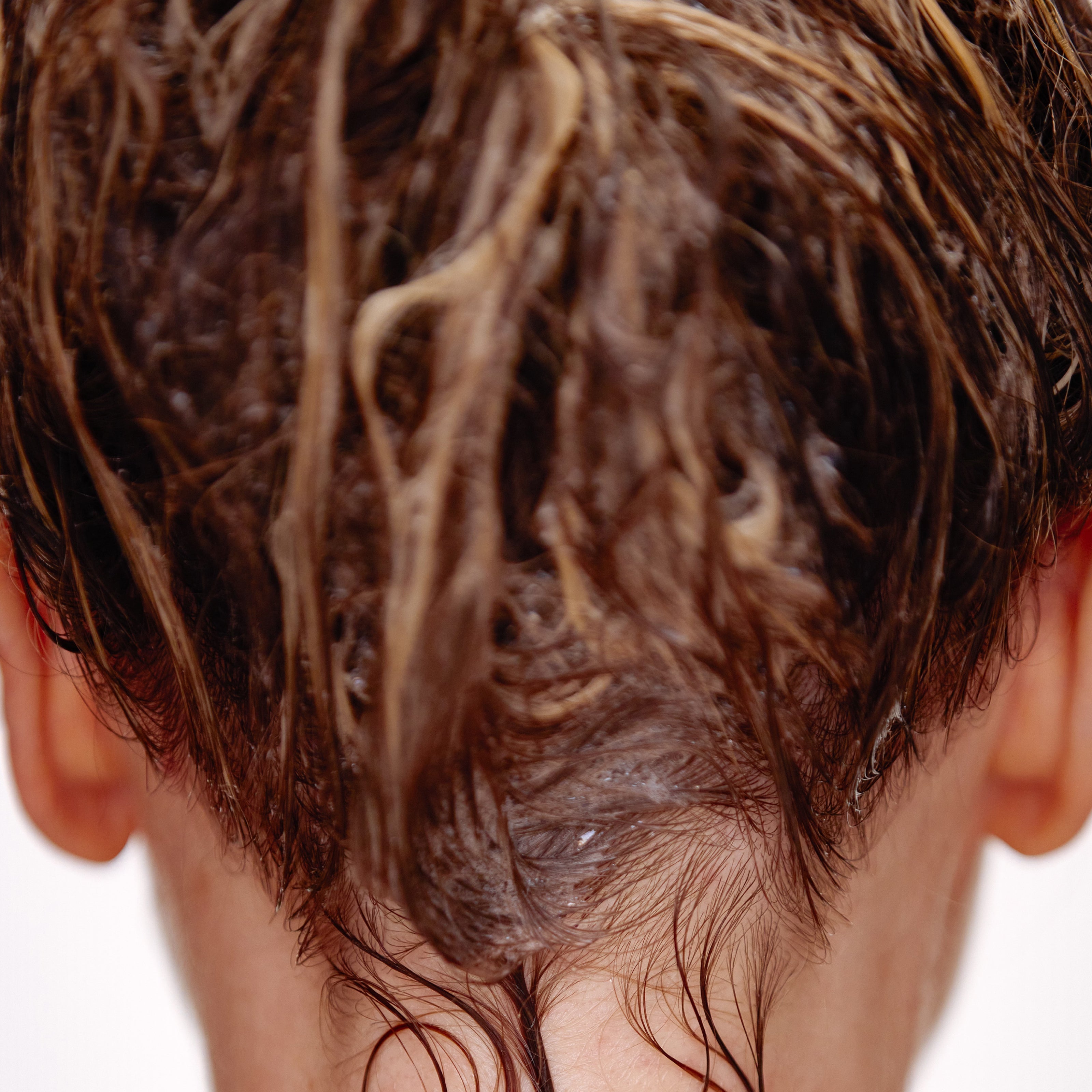 Heavy Hair Shedding? You May Have Telogen Effluvium