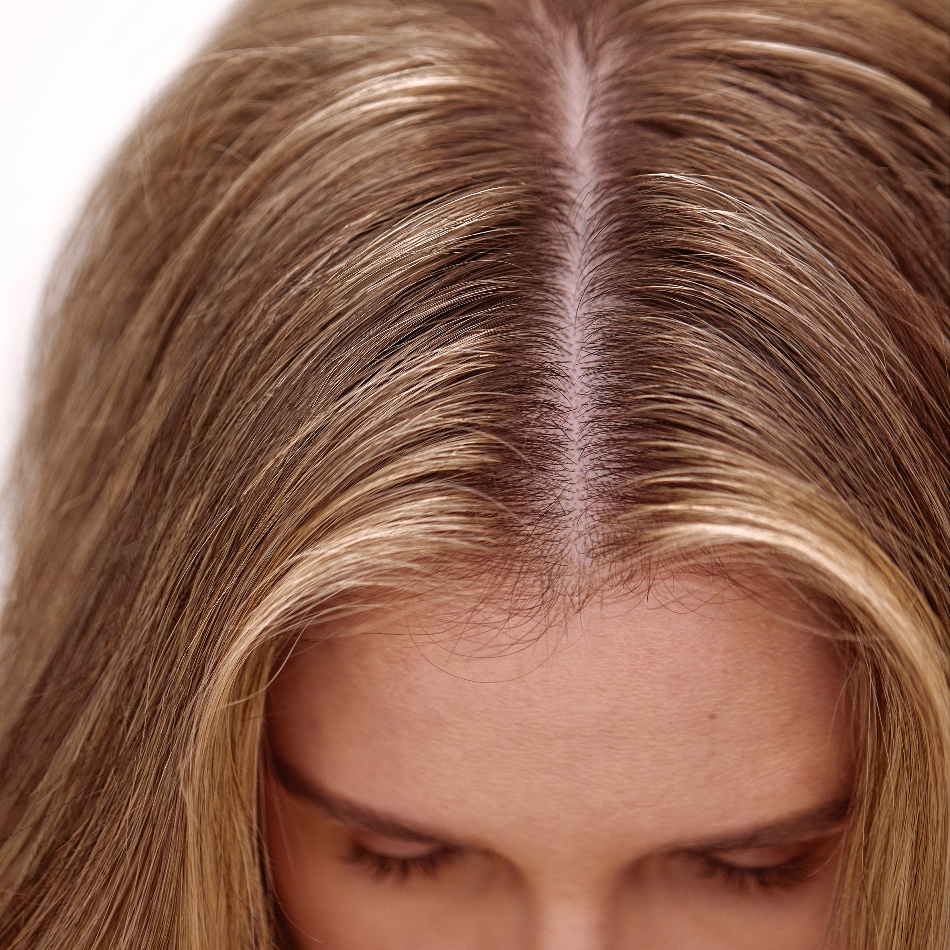 The Why Behind Female Pattern Thinning