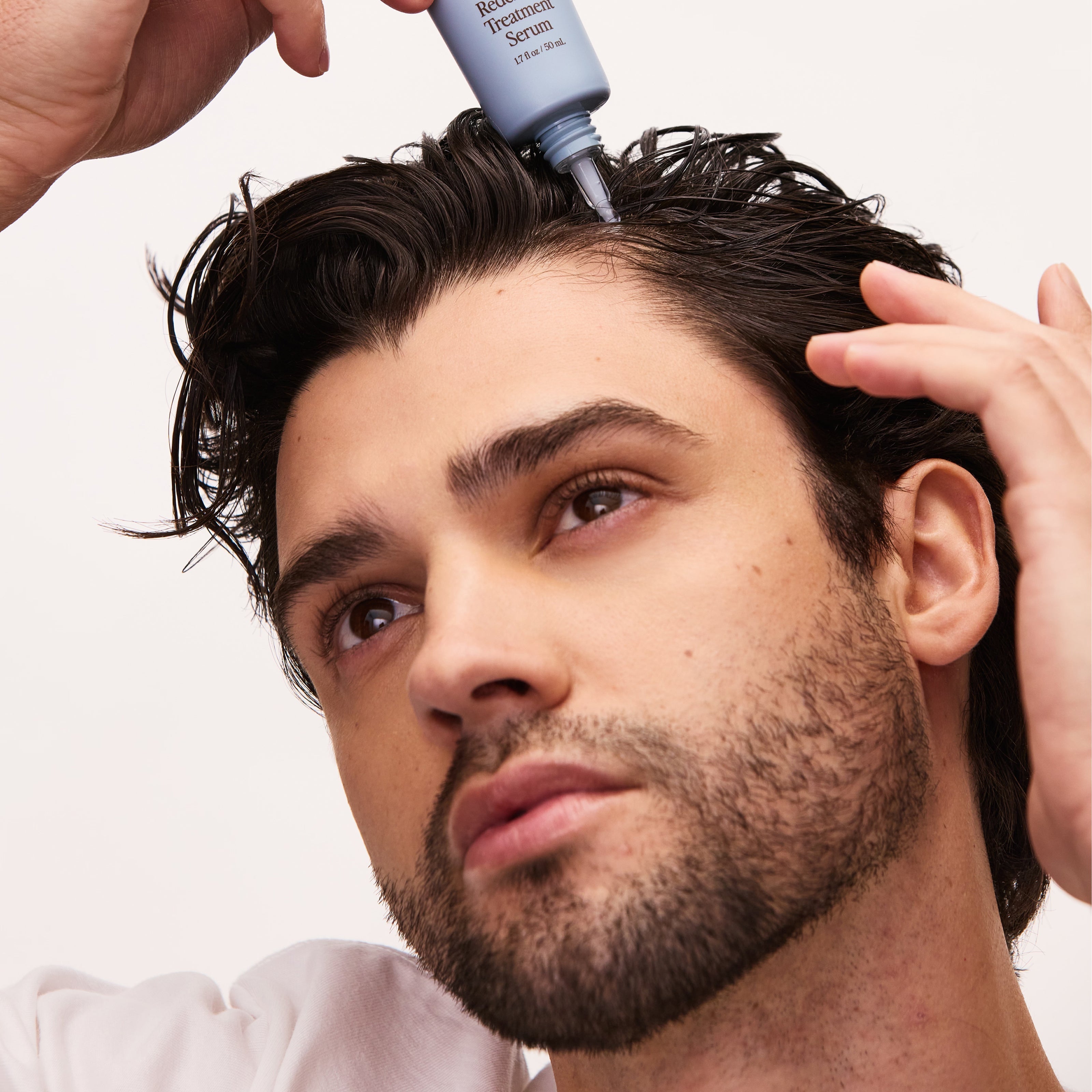 Male Pattern Hair Loss: Understanding Androgenetic Alopecia